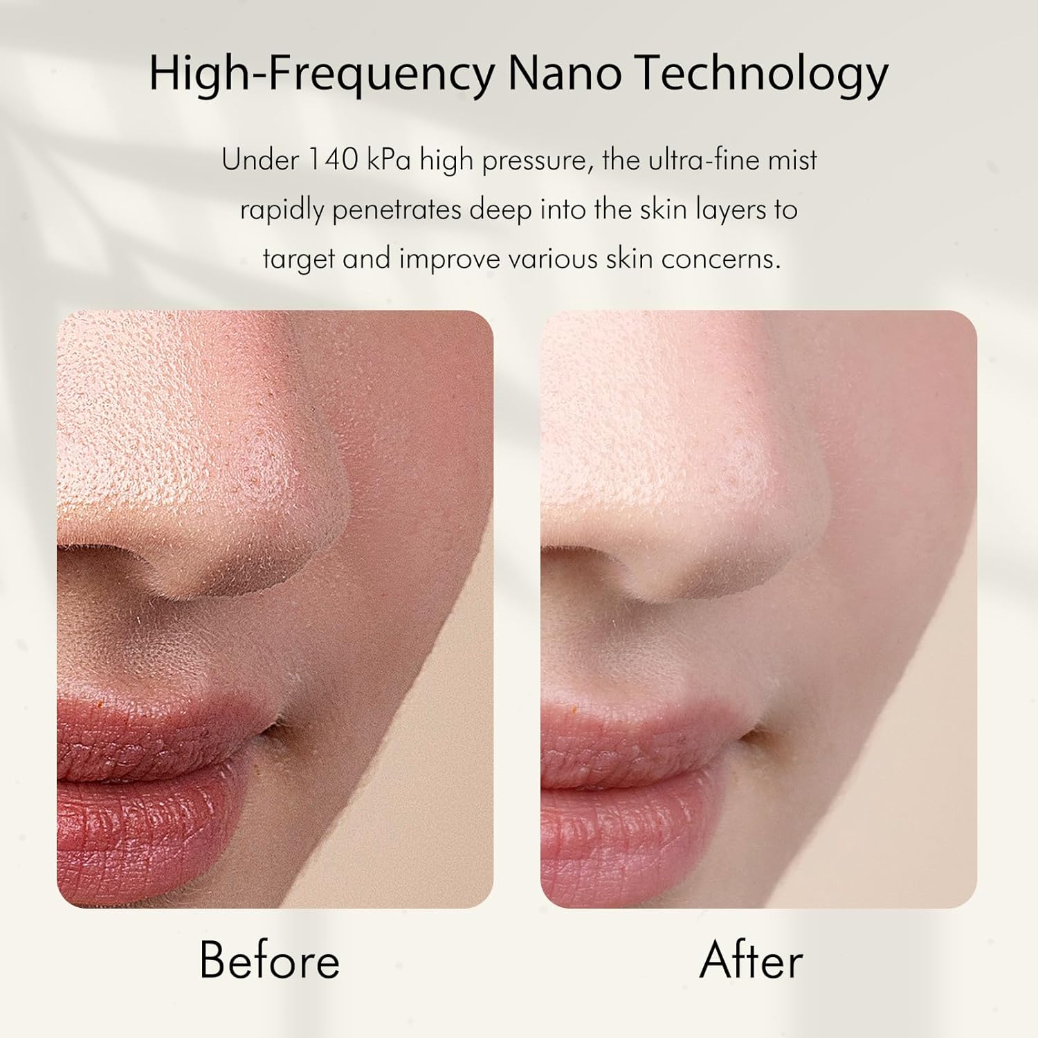 Vaporizzatore Facciale Nano Io - Face Steamer recensione e prezzo